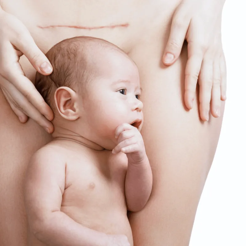 Drainage massage for C-section recovery